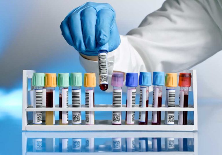 پذیرش گروهی