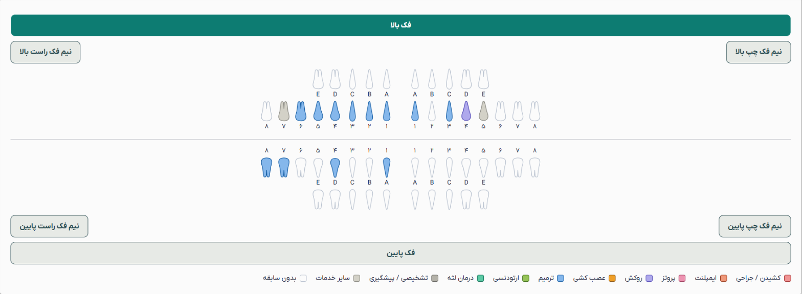نمودار دندانهای شیری و دائمی با رنگبندی انواع درمان در خلاصه پرونده دندانپزشکی